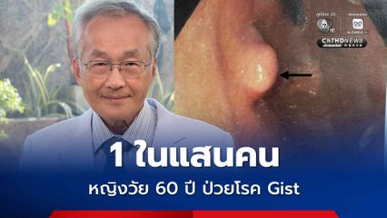 หมอมนูญเผยเคสผู้ป่วย Gist โรคพบยาก ให้ยามะเร็งพุ่งเป้า