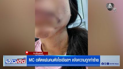 "มิรา" MC อดีตแฟนคนดังโซเชียลฯ แจ้งความถูกทำร้าย