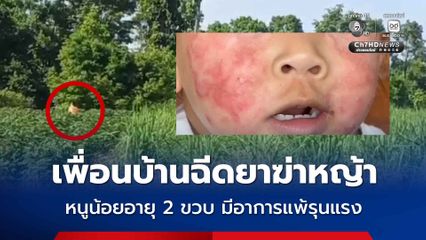 เพื่อนบ้านฉีดยาฆ่าหญ้า หนูน้อยอายุ 2 ขวบ มีอาการแพ้รุนแรง