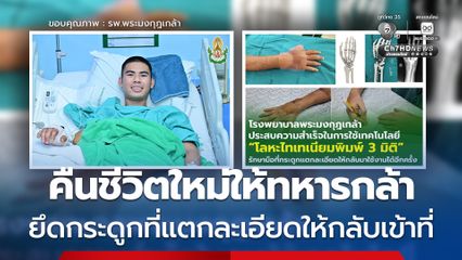รพ.พระมงกุฎฯ ทำสำเร็จ โลหะไทเทเนียมพิมพ์ 3 มิติ รักษาพลทหารรัชชานนท์
