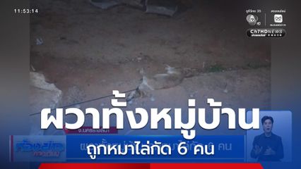 ผวาทั้งหมู่บ้าน ถูกหมาไล่กัด 6 คน