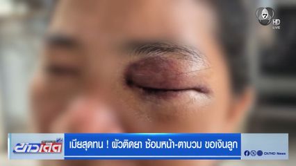 เมียสุดทน ! ผัวติดยา ซ้อมหน้า-ตาบวม ขอเงินลูก