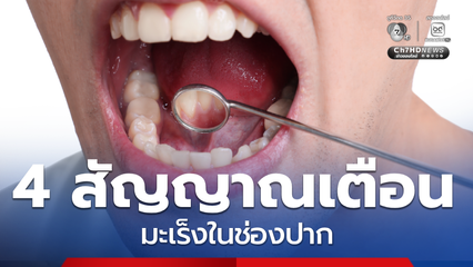อย่ามองข้าม หมอฟันเตือน 4 สัญญาณเตือน มะเร็งในช่องปาก