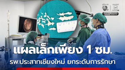 รพ.ประสาทเชียงใหม่ยกระดับการรักษาโรคหมอนรองกระดูกกดทับเส้นประสาท