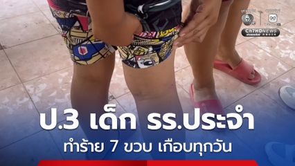 แม่พาลูกชายวัย 7 ขวบ แจ้งความ หลังถูกรุ่นพี่ ป.3 โรงเรียนประจำ รุมทำร้ายเกือบทุกวัน จนไม่อยากเรียน