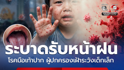 ผู้ปกครองเช็กอาการโรคมือเท้าปาก เริ่มระบาดในเด็ก รับหน้าฝน