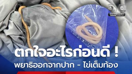 เด็ก 2 ขวบ อาเจียน มีพยาธิไส้เดือนติดในปาก ซ้ำพบไข่พยาธิเต็มท้อง