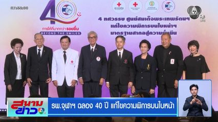 รพ.จุฬาฯ ฉลอง 40 ปี แก้ไขความพิการบนใบหน้า