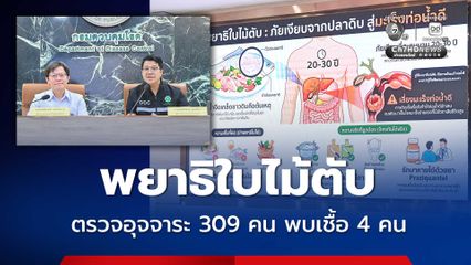พยาธิใบไม้ตับมหาสารคาม ตรวจอุจจาระ 309 คน ผลยืนยันติดเชื้อ 4 คน