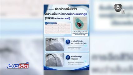 รู้ทันอันตรายโรคหลอดเลือดหัวใจตีบเฉียบพลัน
