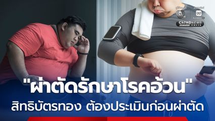 สิทธิบัตรทอง ผ่าตัดรักษาโรคอ้วน ผู้ป่วยต้องมีภาวะอ้วนรุนแรง เข้าเกณฑ์ข้อบ่งชี้ทางการแพทย์