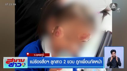 แม่ร้องสื่อฯ ลูกสาว 2 ขวบ ถูกเพื่อนกัดหน้า จ.อุดรธานี