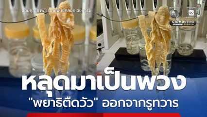 ช็อก ! หลุดมาเป็นพวง "พยาธิตืดวัว" ไม่แสดงอาการกระทั่งหลุดปนออกมากับอุจจาระ หรือคลานออกจากรูทวาร