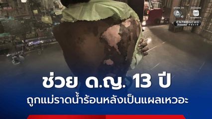 ช่วย ด.ญ. 13 ปี ถูกแม่ราดน้ำร้อนหลังเป็นแผลเหวอะ