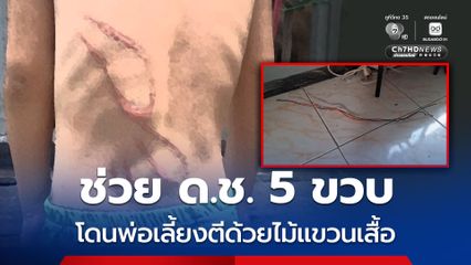 ช่วย ด.ช. 5 ขวบ โดนพ่อเลี้ยงตีด้วยไม้แขวนเสื้อ