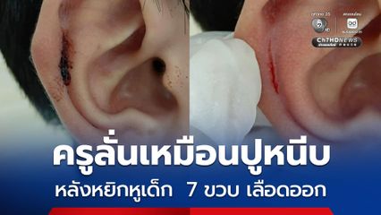 ครูลั่นเหมือนปูหนีบ หลังหยิกหูเด็ก  7 ขวบ เลือดออก