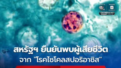 สหรัฐฯ พบผู้เสียชีวิตรายแรก จากโรคติดเชื้อในระบบทางเดินทางอาหาร จากปรสิตไซโคลสปอรา
