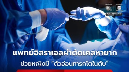 ทีมแพทย์อิสราเอลผ่าตัดเคสสุดหายาก “ตัวอ่อนทารกไปเจริญเติบโตอยู่ในตับ” ของหญิงวัย 40 ปี