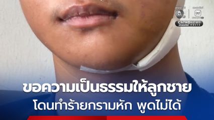 แม่ลูกชายอายุ 17 ปี บาดเจ็บ กรามหัก พูดไม่ได้ หลังถูกกลุ่มวัยรุ่นทำร้าย