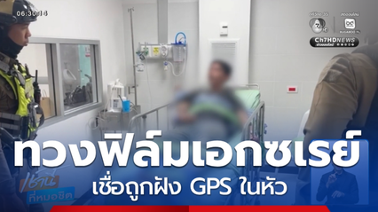 หนุ่มทวงฟิล์มเอกซเรย์ เชื่อถูกฝัง GPS ในหัว