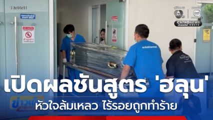 ผลชันสูตร ฮลุน หัวใจล้มเหลว