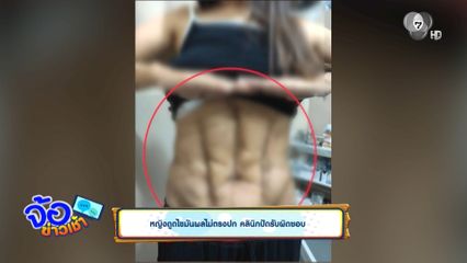หญิงดูดไขมันผลไม่ตรงปก คลินิกปัดรับผิดชอบ