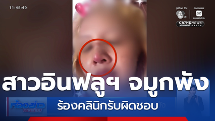 สาวอินฟลูฯ ร้องคลินิกทำจมูกพัง