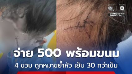 จ่าย 500 พร้อมขนม 4 ขวบ ถูกหมาขย้ำหัว เย็บ 30 กว่าเข็ม