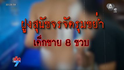 เด็กชาย 8 ขวบ ถูกสุนัขจรจัดรุมขย้ำบาดเจ็บ [เจาะเกาะติด]