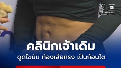 คลินิกเจ้าเดิม ดูดไขมัน ท้องเสียทรง เป็นก้อนไต