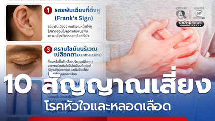 10 สัญญาณเสี่ยง โรคหัวใจและหลอดเลือด มีอาการร่วมรีบพบแพทย์