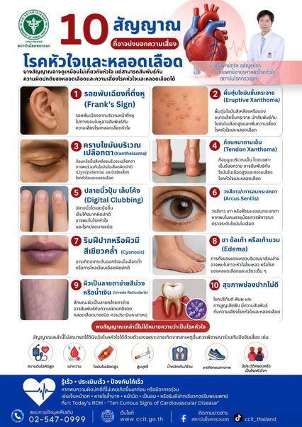 10 สัญญาณเสี่ยง โรคหัวใจและหลอดเลือด มีอาการร่วมรีบพบแพทย์