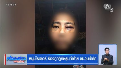 หนุ่มไรเดอร์ ร้องถูกกู้ภัยรุมทำร้าย ชนวนช้ำรัก