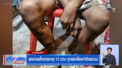 รุดช่วยเด็กชายอายุ 12 ขวบ ถูกพ่อเลี้ยงทำร้ายระบม