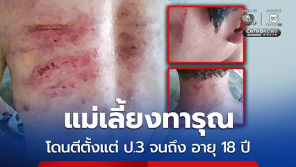 แม่เลี้ยงทารุณ โดนตีตั้งแต่ ป.3 จนถึง อายุ 18 ปี