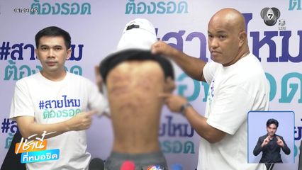 ช่วยหนุ่มถูกแม่เลี้ยงตีนานกว่า 10 ปี