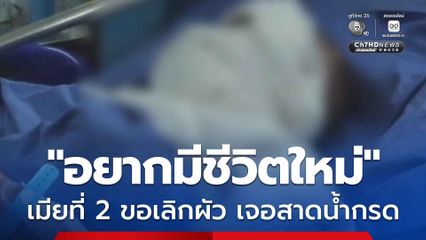 ภรรยาที่ 2 ขอเลิกสามี เจอสาดน้ำกรดใส่