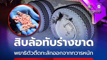 สิบล้อทับร่างขาด พยาธิตัวตืดทะลักออกจากทวารหนัก