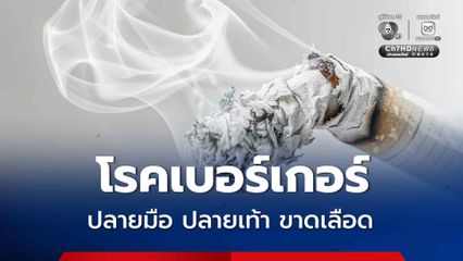 รพ.ราชวิถี เตือนภัยจากบุหรี่ โรคเบอร์เกอร์เสี่ยงสูญเสียอวัยวะ