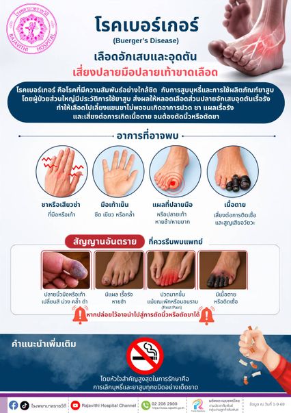 รพ.ราชวิถี เตือนภัยจากบุหรี่ โรคเบอร์เกอร์เสี่ยงสูญเสียอวัยวะ