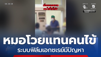 หมอโวยแทนคนไข้ ระบบฟิล์มเอกซเรย์มีปัญหา