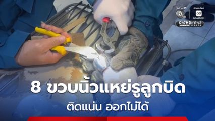 กู้ภัยนำอุปกรณ์ตัดช่วยเหลือ เด็กหญิงอายุ 8 ขวบ นิ้วติดรูลูกบิดประตู