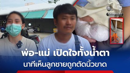 พ่อ-แม่ น้องยูฟ่า เด็ก 1 ขวบ เผยทั้งน้ำตา หลังผู้ช่วยพยาบาลใช้กรรไกรตัดนิ้วลูกขาด