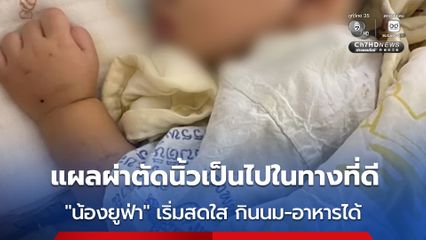 แผลผ่าตัดนิ้วชี้เป็นไปในทางที่ดี น้องยูฟ่า เริ่มสดใสขึ้น กินนม-อาหารได้